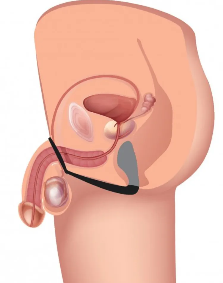Prostatic Play Prostate Massagers | Penis Rings>Explorer II Prostate Stimulator Plus Cock Ring